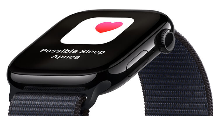 Apple Watch 10 2